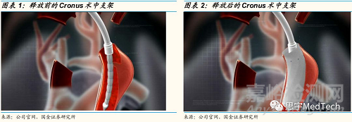 人工血管技術、公司與產品盤點