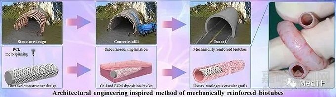 PULSSIBLE：生物型人工血管完成首例臨床入組